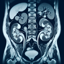 МРТ урографія