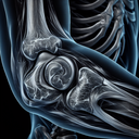 МРТ ліктьового суглобу