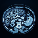 МРТ підшлункової залози